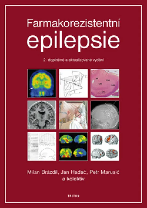Nová Kolekce Farmakorezistentni epilepsie - 2. vydání