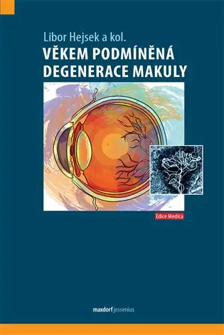 Věkem podmíněná degenerace makuly Zlevněný